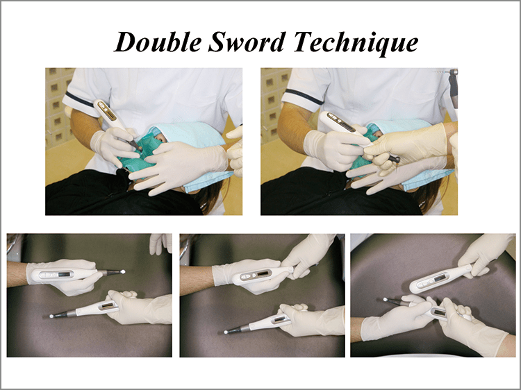 “Double Sword Technique” TRI AUTO mini 2本を同時に使用することによって、ファイル交換に煩わされることなく、チェアタイムは大幅に短縮され、効率的な治療を行うことができる。