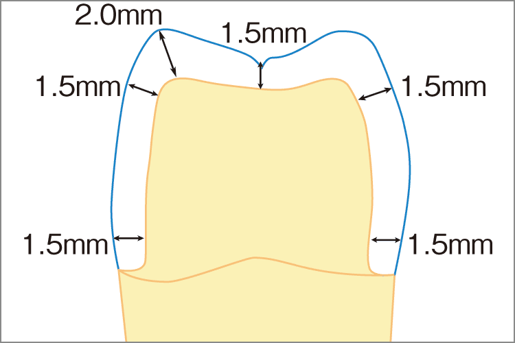 形成 臼歯