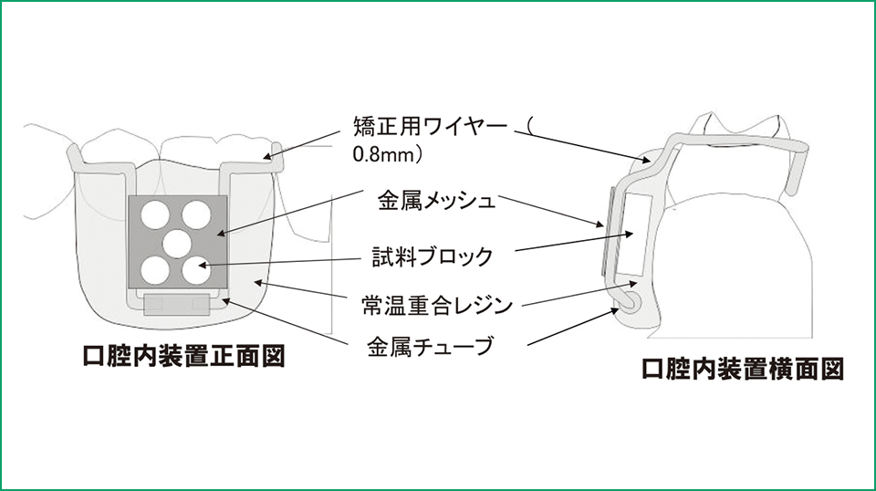 図6 ヒト口腔内に装着するための装置の模式図
