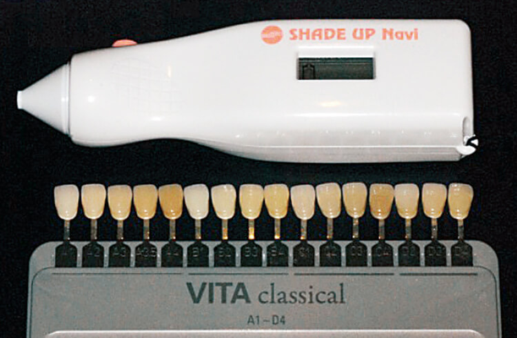 従来の肉眼で行うshade taking（VITA社）は当然のことながら補助的に測色器（松風社）を使用する。