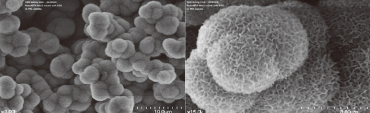 RetroMTAが体液のリン酸塩イオンと反応して、表面にハイドロキシアパタイトが生成されている（拡大率　左：3000倍、右：15000倍）。