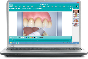 ハイクオリティな3Dアニメーション MedVisor dentalのイメージ