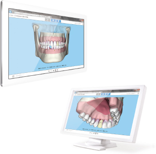 歯周状態説明支援システム Perio 3D Viewのイメージ