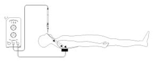 電気的ループの図