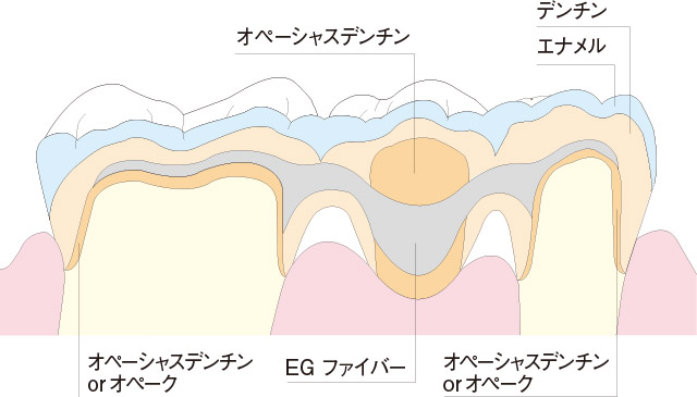 EGファイバーのフレーム形態の図