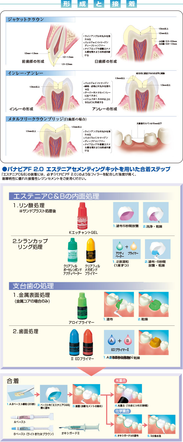 支台形成と合着