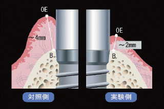 図14