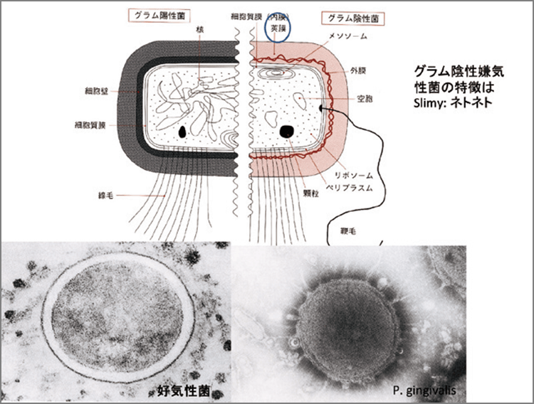 同じ細菌でもグラム陽性菌と陰性菌では細胞を包む機能に大きな違いがある。陽性菌は比較的堅固な細胞膜と細胞壁を持っていて、細胞内容物を守っている。一方、陰性菌は莢膜や粘液層といったネトネトした粘液構造物によって被覆されている。陰性菌に圧倒的に病原性が高いのも、こういった構造で自身の抗原性をカモフラージュするためと思われる。