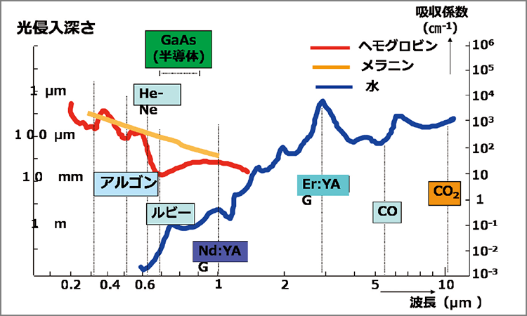 レーザーの波長域別特性