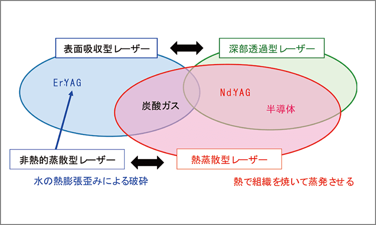 Er：YAGレーザーは表面吸収型非熱的蒸散レーザー