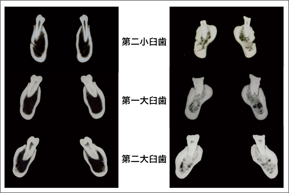図5 縄文時代人（左）と現代日本人（右）の下顎臼歯のCT