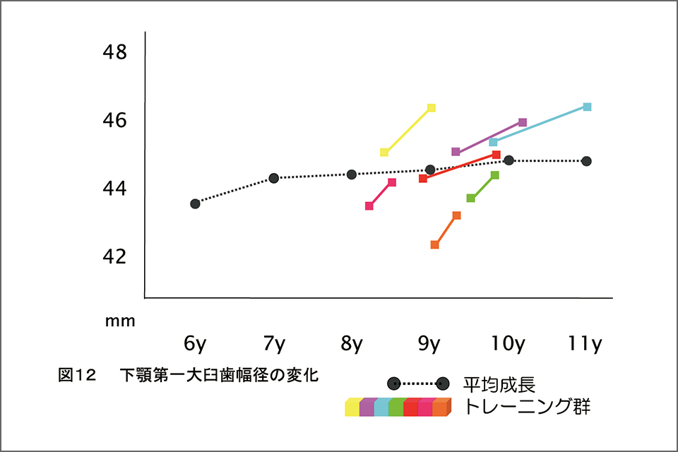 図12 下顎第一大臼歯幅径の変化