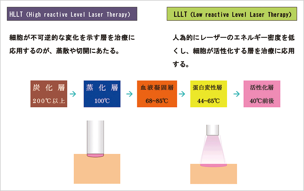 HLLTとLLLTの比較図