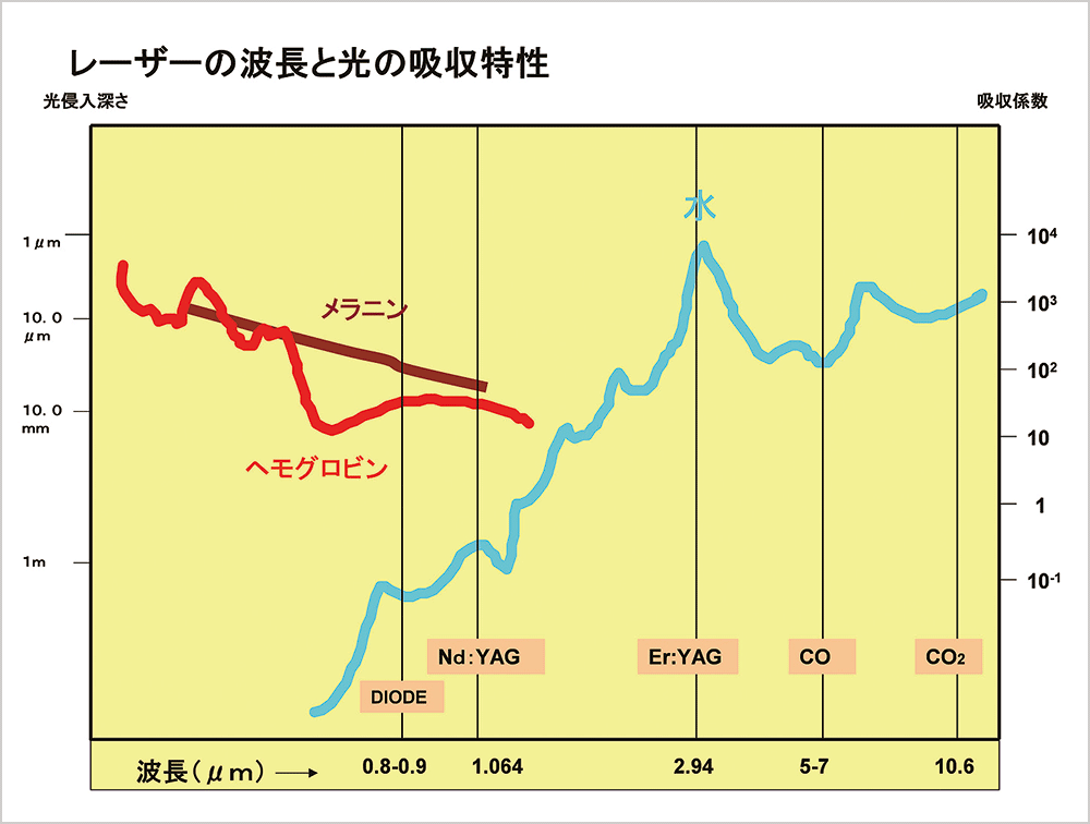 レーザーの波長と光の吸収特のグラフ