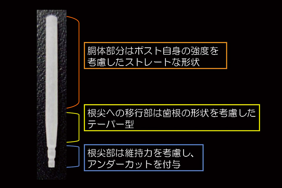 図5　ファイバーポストの形態の特徴