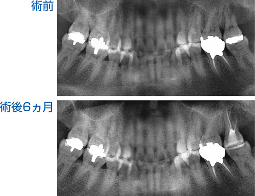 術前術後の比較写真