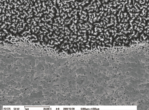 う蝕象牙質第２層（CAD）と硬化したハイブリッドコートⅡとの接合界面の強拡大像（ｘ20,000）