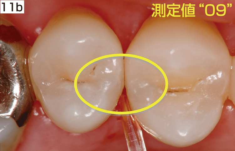 11b 測定値09