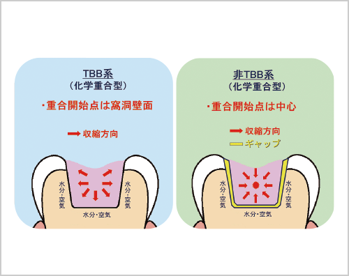 接着性レジンの重合開始剤の特長