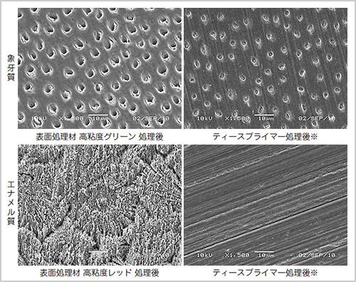 各種歯面処理後のSEM像