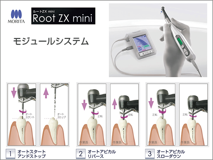 モジュ－ルシステム Root ZX mini（ルートZX mini）とのコラボレ－ションによって、３オ－ト機能（スタ－トアンドストップ・アピカルリバ－ス・アピカルスロ－ダウン）が利用できる。