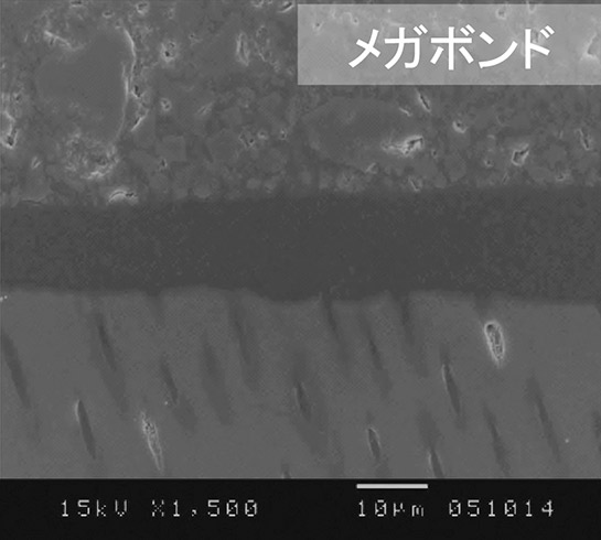 図12 メガボンドの接着界面の走査電顕像。