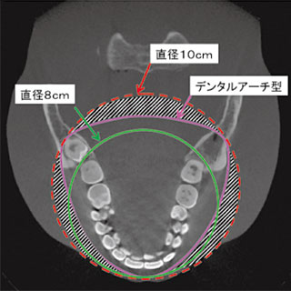 全顎撮像