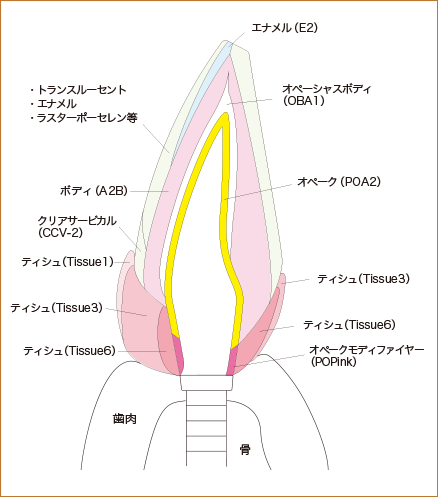 今回使用した歯肉色陶材の図