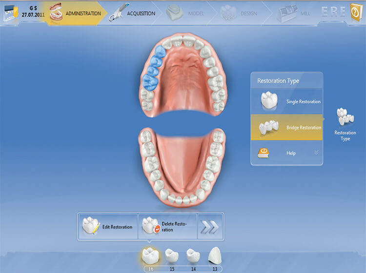 修復物設定画面。より視覚直感的にデザインされた画面。修復歯をクリックしてレストレーションタイプを決定する。