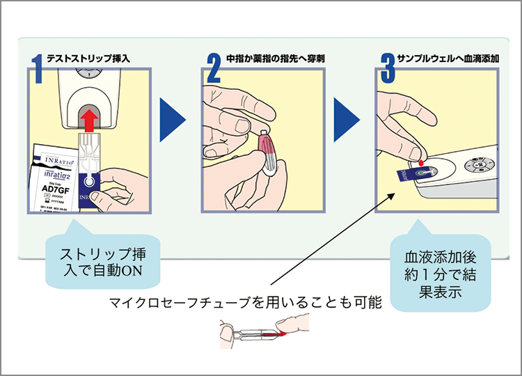 操作手順 3ステップの簡単操作で、検査時間は約１分と短時間である。