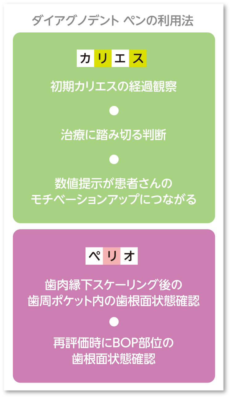 ダイアグノデント ペンの利用方法