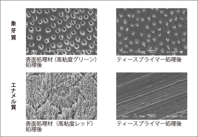 表面処理材およびティースプライマー処理後のSEM写真。応力の掛かる部位では表面処理材レッドとの併用も行っている。