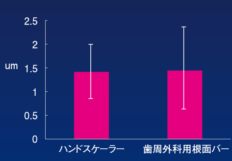 実験結果（表面粗さ）：手用スケーラーと同等である＜ウィルコクソン符号付順位和検定において統計学的有意差は認められなかった＞。