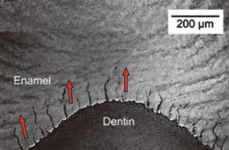 象牙エナメル境のエナメル質側にEnamel tufts（叢）が多数存在している。一種のヒビ状のものに見える。このTuftsは対合歯と出会う前から存在している。