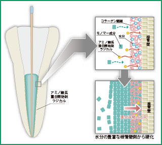 重合収縮の発生する方向の図