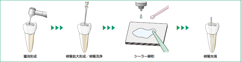 使用方法の図