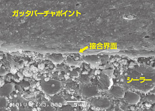 ガッタパーチャポイント/シーラーの接合界面の画像