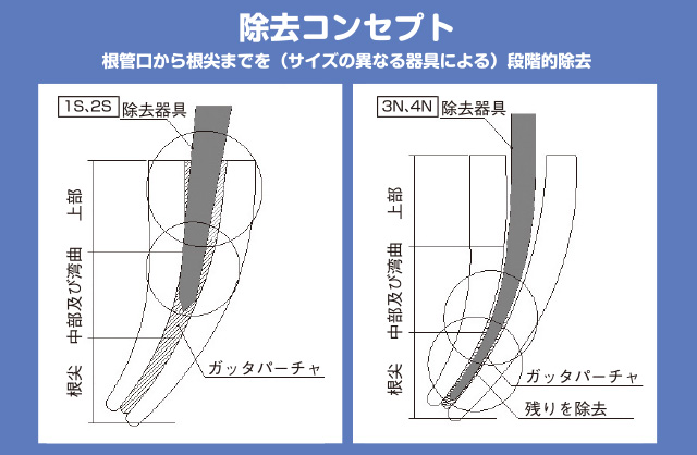 GPRの除去コンセプト図