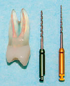 人工歯と1S・2Sの画像