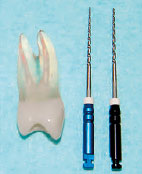 人工歯と3N・4Nの画像
