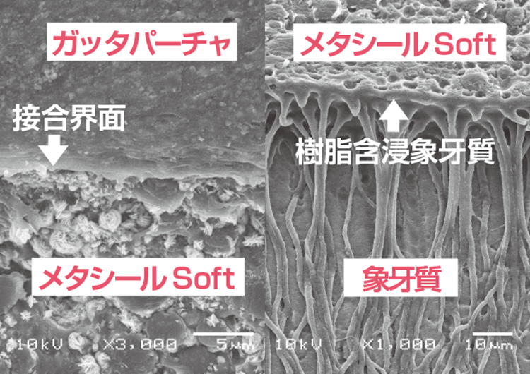 メタシールSoftの接着界面SEM写真 左：ガッタパーチャとの接着界面 右：根管象牙質との接着界面
