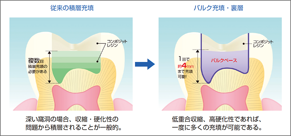 図2　バルクベースの特長と有用性