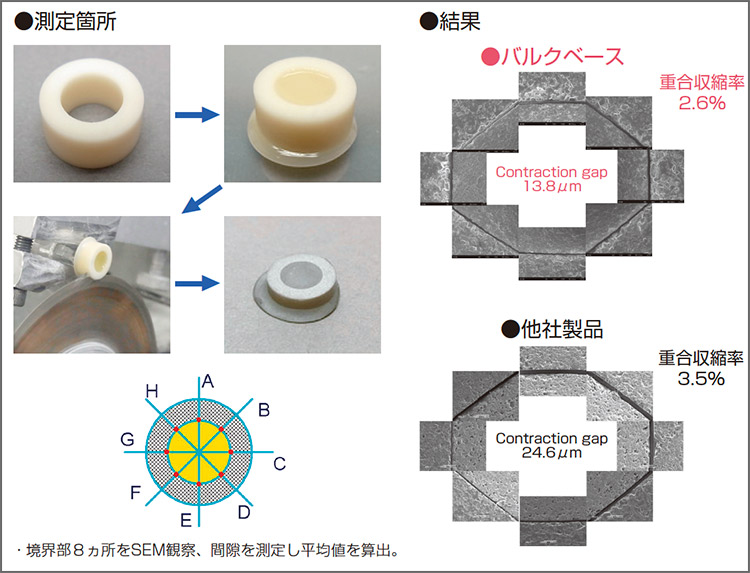 図3　コントラクションギャップと重合収縮率