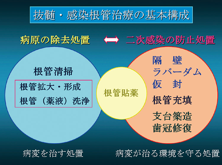 図1　根尖歯周組織の治癒は根管内の「病原の除去処置」によって導かれ、「二次感染の防止処置」がこれを保持する。根管充填は二次感染の防止処置の一つである。