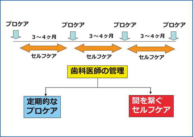 SPT期におけるセルフケアの位置づけの図