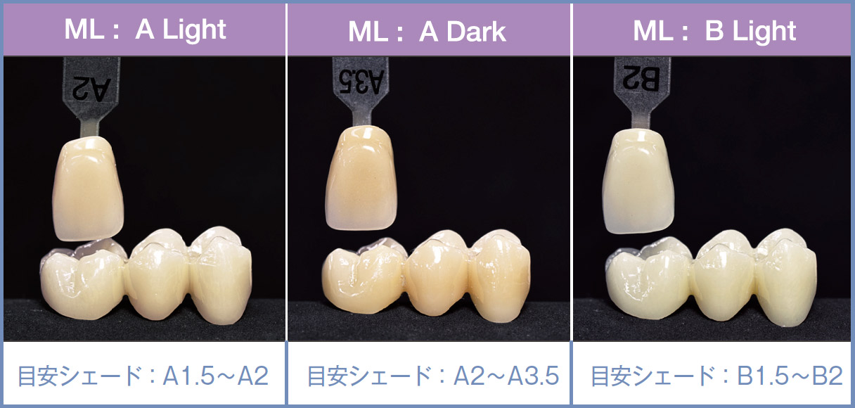 図3　MLシリーズ：フルジルコニアクラウンの製作を目的としたマルチレイヤードタイプ。