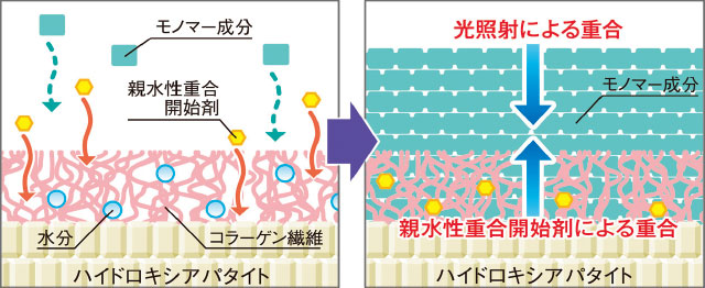 親水性重合触媒のしくみ図