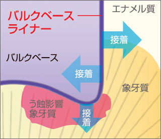 バルクベースライナーの優れた接着性能図