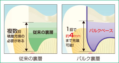 硬化深度4mmの高い光硬化性の図