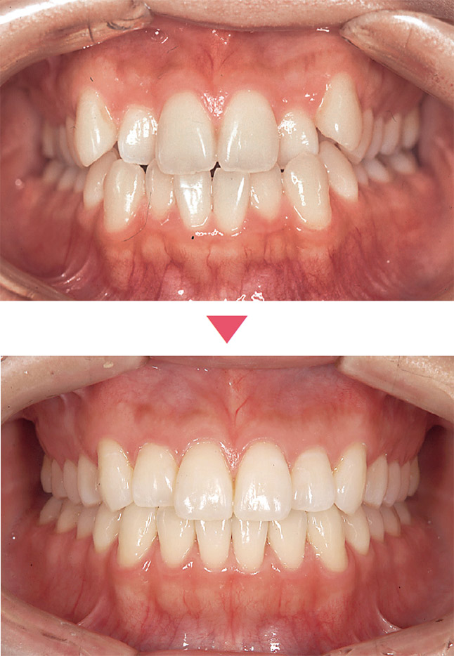 矯正治療を行うことにより環境の改善が可能となる。